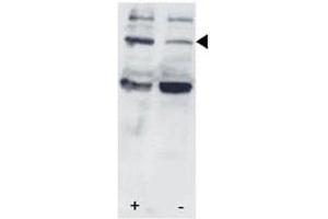 Western Blotting (WB) image for anti-Signal Transducer and Activator of Transcription 3 (Acute-Phase Response Factor) (STAT3) (pSer727) antibody (ABIN3032570)