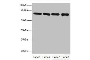 Western Blotting (WB) image for anti-Peptidyl Arginine Deiminase, Type II (PADI2) (AA 1-665) antibody (ABIN7166388)
