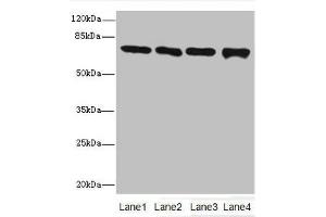 Western blot All lanes: Protein-arginine deiminase type-2 antibody at 16 μg/mL Lane 1: PC-3 whole cell lysate Lane 2: Hela whole cell lysate Lane 3: Mouse brain tissue Lane 4: MDA-MB-231 whole cell lysate Secondary Goat polyclonal to rabbit IgG at 1/10000 dilution Predicted band size: 76, 50 kDa Observed band size: 76 kDa (PADI2 抗体  (AA 1-665))