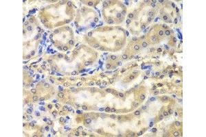 Immunohistochemistry of paraffin-embedded Mouse kidney using Myelin Basic protein Polyclonal Antibody at dilution of 1:200 (40x lens). (MBP 抗体)