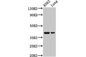 Western Blot Positive WB detected in: K562 whole cell lysate, Rat lung tissue All lanes: PTX3 antibody at 2 μg/mL Secondary Goat polyclonal to rabbit IgG at 1/50000 dilution Predicted band size: 42 kDa Observed band size: 42 kDa (PTX3 抗体  (AA 99-164))
