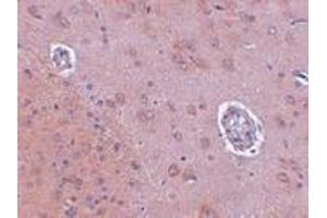 Immunohistochemistry (IHC) image for anti-Family with Sequence Similarity 120A (FAM120A) (Middle Region) antibody (ABIN1030930)