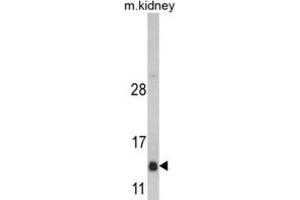 Western Blotting (WB) image for anti-DnaJ (Hsp40) Homolog, Subfamily C, Member 19 (DNAJC19) antibody (ABIN3002676) (DNAJC19 抗体)