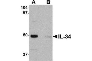 Western blot analysis of IL-34 in human brain tissue lysate with IL-34 antibody at 0. (IL-34 抗体  (Center))
