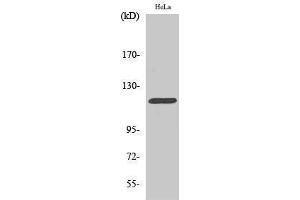 Western Blotting (WB) image for anti-Cas-Br-M (Murine) Ecotropic Retroviral Transforming Sequence (CBL) (Ser207) antibody (ABIN3179912) (CBL 抗体  (Ser207))