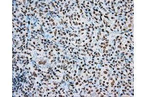 Immunohistochemical staining of paraffin-embedded Kidney tissue using anti-ARNT mouse monoclonal antibody. (ARNT 抗体)