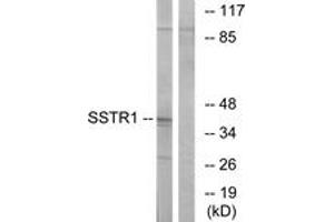 Western blot analysis of extracts from COS7 cells, using SSTR1 Antibody. (SSTR1 抗体  (AA 9-58))
