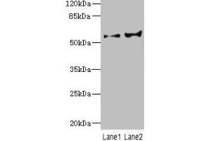 Western blot All lanes: CYP2C18 antibody at 5. (CYP2C18 抗体  (AA 231-490))