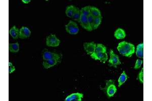 Immunofluorescent analysis of MCF-7 cells using ABIN7151556 at dilution of 1:100 and Alexa Fluor 488-congugated AffiniPure Goat Anti-Rabbit IgG(H+L) (ELOVL1 抗体  (AA 82-175))