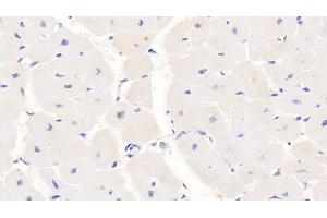 Detection of S100 in Human Cardiac Muscle Tissue using Monoclonal Antibody to S100 Calcium Binding Protein (S100) (S100 Protein (S100) (AA 1-94) 抗体)