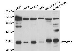 Western blot analysis of extracts of various cell lines, using PTGES2 antibody. (PTGES2 抗体  (AA 88-377))