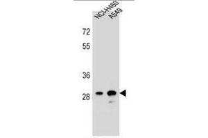 anti-Dehydrogenase/reductase (SDR Family) Member 4 Like 1 (DHRS4L1) (AA 221-250), (C-Term) antibody