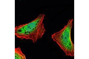 Immunofluorescence analysis of NTERA-2 cells using ATXN1 mouse mAb (green). (Ataxin 1 抗体)
