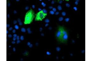 Immunofluorescence (IF) image for anti-Dipeptidyl-Peptidase 9 (DPP9) antibody (ABIN1497896) (DPP9 抗体)