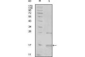 Western Blot showing TNK1 antibody used against truncated TNK1-His recombinant protein (1). (TNK1 抗体  (AA 451-560))