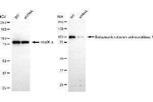 Western blotting analysis using endoplasmic reticulum aminopeptidase 1 antibody (ABIN7798442). (Recombinant ERAP1 抗体)