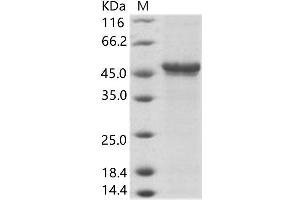Western Blotting (WB) image for Bundibugyo Ebola Virus Envelope Glycoprotein (BEBOV GP) protein (Fc Tag) (ABIN7198901) (BEBOV GP Protein (Fc Tag))