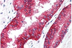 Immunohistochemistry (IHC) image for anti-Potassium Intermediate/small Conductance Calcium-Activated Channel, Subfamily N, Member 4 (KCNN4) (C-Term) antibody (ABIN1048993)
