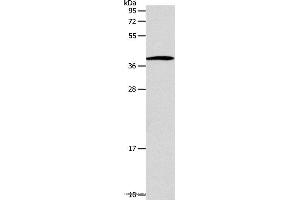 Western blot analysis of Human lymphoma tissue, using SLC25A11 Polyclonal Antibody at dilution of 1:600 (SLC25A11 抗体)