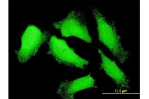 Immunofluorescence of monoclonal antibody to NXT1 on HeLa cell. (NXT1 抗体  (AA 1-140))