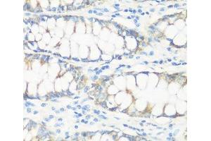 Immunohistochemistry of paraffin-embedded Human colon using NMT1 Polyclonal Antibody at dilution of 1:100 (40x lens). (NMT1 抗体)