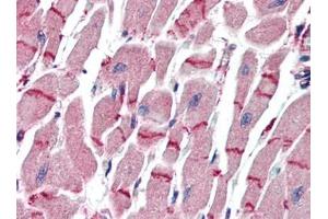 Human Heart (formalin-fixed, paraffin-embedded) stained with APAF1at 10 µg/ml followed by biotinylated goat anti-rabbit IgG secondary antibody, alkaline phosphatase-streptavidin and chromogen. (APAF1 抗体  (C-Term))