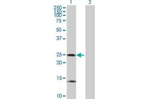 Western Blot analysis of ARHGDIA expression in transfected 293T cell line by ARHGDIA MaxPab polyclonal antibody.