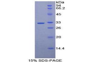 SDS-PAGE analysis of Human MAEA Protein.