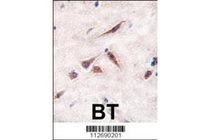 Formalin-fixed and paraffin-embedded human brain tissue reacted with ERAS antibody (A28), which was peroxidase-conjugated to the secondary antibody, followed by DAB staining. (ERAS 抗体  (N-Term))