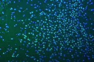 IF analysis of SF3B3 using anti-SF3B3 antibody (ABIN7602378).