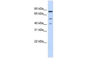 WB Suggested Anti-STAT3 Antibody Titration:  0. (STAT3 抗体  (Middle Region))