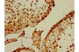 Immunohistochemistry of paraffin-embedded human testis tissue using ABIN7163840 at dilution of 1:100 (PQBP1 抗体  (AA 2-265))