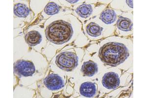 Paraformaldehyde-fixed, paraffin embedded mouse skin section, Antigen retrieval by boiling in sodium citrate buffer (pH6) for 15min, Block endogenous peroxidase by 3% hydrogen peroxide for 30 minutes, Blocking buffer at 37°C for 20min, Antibody incubation with Smad3(S423/S425) (5C5 ) Monoclonal Antibody  at 1:50 overnight at 4°C, followed by a conjugated secondary and DAB staining.