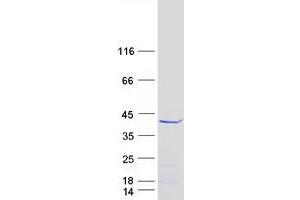 Western Blotting (WB) image for Family with Sequence Similarity 76, Member A (FAM76A) (Transcript Variant 3) protein (Myc-DYKDDDDK Tag) (ABIN2720805)
