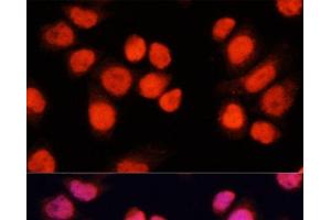 Immunofluorescence analysis of Hela cells using CHAMP1 Polyclonal Antibody at dilution of 1:100 (40x lens). (ZNF828 抗体)
