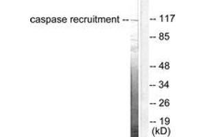 Western blot analysis of extracts from HeLa cells, using CARD6 Antibody. (CARD6 抗体  (AA 1-50))
