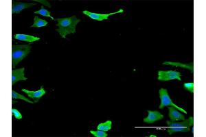 Immunofluorescence of monoclonal antibody to TUBA1B on HeLa cell. (TUBA1B 抗体  (AA 1-451))