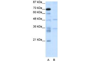 WB Suggested Anti-HTLF Antibody Titration:  2. (FOXN2 抗体  (C-Term))