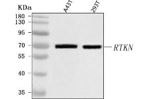 Western blot analysis of RTKN using anti-RTKN antibody (ABIN7600934).