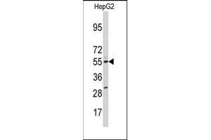 Image no. 1 for anti-Cytochrome P450, Family 11, Subfamily A, Polypeptide 1 (CYP11A1) (N-Term) antibody (ABIN360271) (CYP11A1 抗体  (N-Term))
