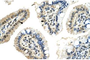 Immunohistochemistry (IHC) image for anti-Poly-U Binding Splicing Factor 60KDa (PUF60) (C-Term) antibody (ABIN2779054)