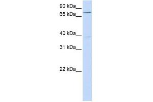 C17ORF80 antibody used at 1 ug/ml to detect target protein. (HLC8 抗体  (N-Term))