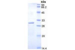 SDS-PAGE analysis of Mouse DLAT Protein.
