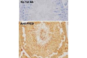 Immunohistochemistry (IHC) image for anti-Formiminotransferase Cyclodeaminase (FTCD) (N-Term) antibody (ABIN6254252) (FTCD 抗体  (N-Term))