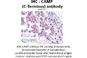 Image no. 1 for anti-Cathelicidin Antimicrobial Peptide (CAMP) (C-Term) antibody (ABIN1732585) (Cathelicidin 抗体  (C-Term))