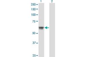Western Blot analysis of ATP6AP1 expression in transfected 293T cell line by ATP6AP1 monoclonal antibody (M02), clone 3B11. (ATP6AP1 抗体  (AA 51-150))