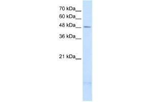 WB Suggested Anti-PSD3 Antibody Titration:  2. (PSD3 抗体  (Middle Region))
