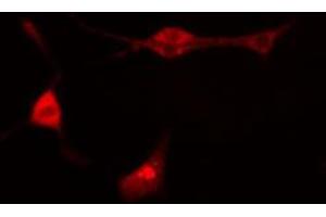 ABIN6274268 staining Hela cells by IF/ICC.
