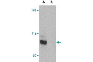 Western blot analysis of JPH3 in Daudi cell lysate with JPH3 polyclonal antibody  at 1 ug/mL in (A) the absence and (B) the presence of blocking peptide. (Junctophilin 3 抗体  (C-Term))