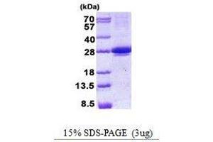 Figure annotation denotes ug of protein loaded and % gel used. (MIS12 蛋白)